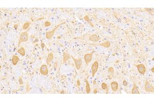 Detection of MAP2 in Rat Cerebellum Tissue using Polyclonal Antibody to Microtubule Associated Protein 2 (MAP2) (MAP2 抗体  (AA 1459-1718))