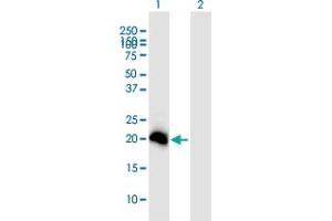 Western Blot analysis of N6AMT1 expression in transfected 293T cell line ( H00029104-T01 ) by N6AMT1 MaxPab polyclonal antibody. (N6AMT1 抗体  (AA 1-186))