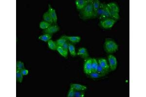 Immunofluorescent analysis of HepG2 cells using ABIN7150898 at dilution of 1:100 and Alexa Fluor 488-congugated AffiniPure Goat Anti-Rabbit IgG(H+L) (TCTE1 抗体  (AA 285-501))
