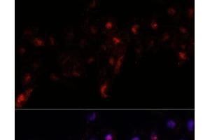 Immunofluorescence analysis of L929 cells using PEX10 Polyclonal Antibody at dilution of 1:100. (PEX10 抗体)