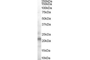 Image no. 1 for anti-Vacuolar Protein-Sorting-Associated Protein 25 (VPS25) (Internal Region) antibody (ABIN374641) (VPS25 抗体  (Internal Region))