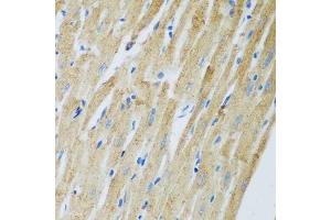 Immunohistochemistry of paraffin-embedded rat heart using ADAM12 antibody. (ADAM12 抗体  (AA 589-738))