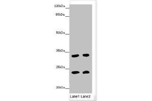 Western blot All lanes: MRAS antibody at 3. (MRAS 抗体  (AA 79-208))