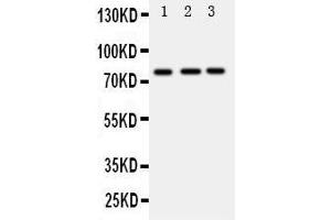 Western Blotting (WB) image for anti-DEAD Box Protein 4 (DDX4) (AA 253-272), (Middle Region) antibody (ABIN3044032)