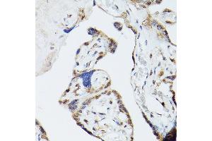 Immunohistochemistry of paraffin-embedded human placenta using ADK Rabbit pAb (ABIN7265463) at dilution of 1:300 (40x lens). (ADK 抗体  (AA 200-345))