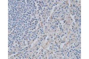 Immunohistochemical staining of formalin-fixed paraffin-embedded human tonsil tissue showing cytoplasmic staining with CASP4 polyclonal antibody  at 1 : 100 dilution. (Caspase 4 抗体)