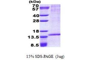 SDS-PAGE (SDS) image for RAB8B, Member RAS Oncogene Family (RAB8B) (AA 1-204) protein (His tag) (ABIN5853051) (RAB8B Protein (AA 1-204) (His tag))