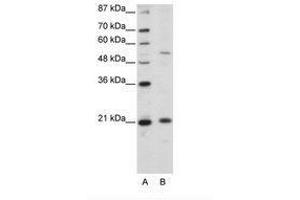 Image no. 1 for anti-Zinc Finger and SCAN Domain Containing 20 (ZSCAN20) (N-Term) antibody (ABIN203137) (ZSCAN20 抗体  (N-Term))