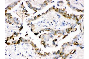 Immunohistochemistry (Paraffin-embedded Sections) (IHC (p)) image for anti-Surfactant Protein D (SFTPD) (AA 292-321), (C-Term) antibody (ABIN3043335) (SFTPD 抗体  (C-Term))