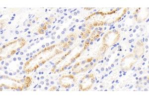 Detection of MMP13 in Rabbit Kidney Tissue using Polyclonal Antibody to Matrix Metalloproteinase 13 (MMP13) (MMP13 抗体  (AA 70-245))