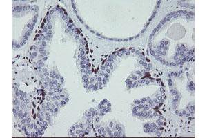Image no. 8 for anti-Meis Homeobox 3 (MEIS3) (AA 1-261) antibody (ABIN1490671) (MEIS3 抗体  (AA 1-261))