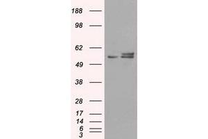 Image no. 2 for anti-ATP Synthase, H+ Transporting, Mitochondrial F1 Complex, beta Polypeptide (ATP5B) antibody (ABIN1496766)