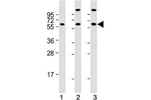 Western blot testing of human 1) K562, 2) 293 and 3) Jurkat cell lysate with HSP60 antibody. (HSPD1 抗体  (AA 80-109))