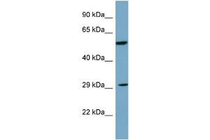 Host: Rabbit Target Name: DKK1 Sample Type: PANC1 Whole Cell lysates Antibody Dilution: 1. (DKK1 抗体  (C-Term))