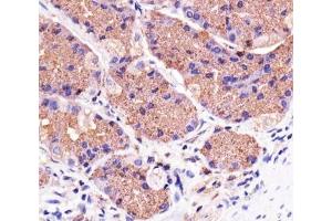 Immunohistochemistry (IHC) image for anti-PTEN Induced Putative Kinase 1 (PINK1) antibody (ABIN3028956)