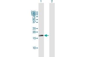 Western Blot analysis of APITD1 expression in transfected 293T cell line by APITD1 MaxPab polyclonal antibody. (APITD1 抗体  (AA 1-138))