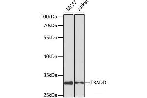 Western blot analysis of extracts of various cell lines using TRADD Polyclonal Antibody at dilution of 1:1000. (TRADD 抗体)