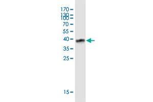 Western Blotting (WB) image for anti-Proteolipid Protein 2 (PLP2) (AA 1-152) antibody (ABIN2565790)