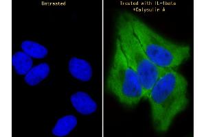 Immunofluorescent analysis of 4 % paraformaldehyde-fixed, 0. (TR4 抗体  (pSer439))