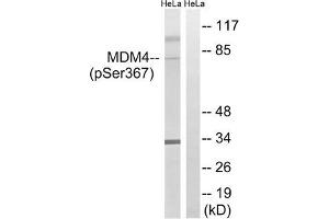 Western blot analysis of extracts from HeLa cells, treated with calyculinA (50 ng/mL, 30 mins), using MDM4 (Phospho-Ser367) antibody. (MDM4-binding Protein 抗体  (pSer367))