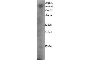 Image no. 1 for anti-Dedicator of Cytokinesis 1 (DOCK1) (C-Term) antibody (ABIN374114) (DOCK1 抗体  (C-Term))