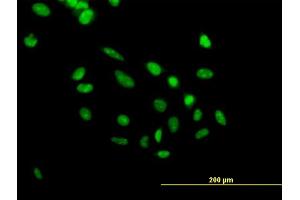 Immunofluorescence of purified MaxPab antibody to PHF10 on HeLa cell. (PHF10 抗体  (AA 1-410))