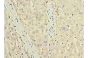Immunohistochemistry of paraffin-embedded human liver tissue using ABIN7173508 at dilution of 1:100 (TRIT1 抗体  (AA 1-324))