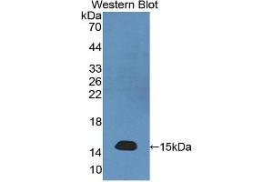 Western Blotting (WB) image for anti-Neurofilament, Light Polypeptide (NEFL) (AA 281-396) antibody (ABIN1176228) (NEFL 抗体  (AA 281-396))