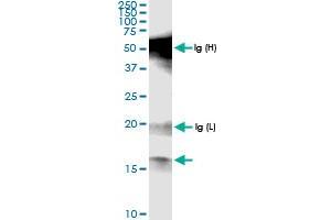 Immunoprecipitation of POLR1D transfected lysate using anti-POLR1D MaxPab rabbit polyclonal antibody and Protein A Magnetic Bead , and immunoblotted with POLR1D MaxPab rabbit polyclonal antibody (D01) . (POLR1D 抗体  (AA 1-133))