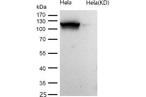 Western Blotting (WB) image for anti-ATPase, Ca++ Transporting, Cardiac Muscle, Slow Twitch 2 (ATP2A2) antibody (ABIN7606948)