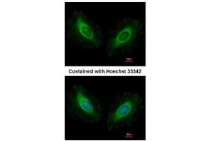 ICC/IF Image Immunofluorescence analysis of methanol-fixed HeLa, using Calmodulin 2, antibody at 1:500 dilution. (Calmodulin 2 抗体)