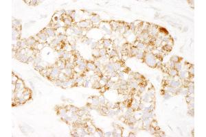 Immunohistochemistry (IHC) image for anti-Prohibitin (PHB) (AA 222-272) antibody (ABIN7448745)