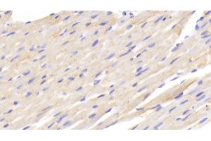 Detection of FABP1 in Rat Cardiac Muscle Tissue using Polyclonal Antibody to Fatty Acid Binding Protein 1 (FABP1)