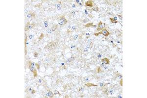 Immunohistochemistry (Paraffin-embedded Sections) (IHC (p)) image for anti-ATP-Binding Cassette, Sub-Family B (MDR/TAP), Member 8 (ABCB8) (AA 469-718) antibody (ABIN3016383)