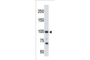 The anti-ACE2 C-term Pab f is used in Western blot to detect ACE2 in 293 cell lysate. (ACE2 抗体  (C-Term))