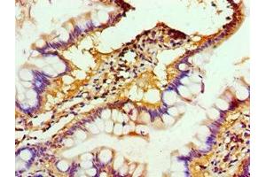 Immunohistochemistry of paraffin-embedded human small intestine tissue using ABIN7150218 at dilution of 1:100 (ALKBH2 抗体  (AA 1-261))