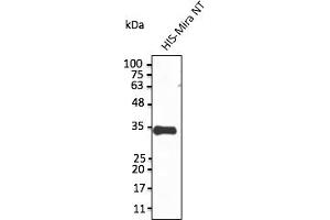 Western Blotting (WB) image for anti-Sarcolemma Associated Protein (SLMAP) (N-Term) antibody (ABIN7273079)