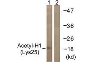 Western blot analysis of extracts from COS7 cells, treated with TSA 400nM 24h, using Histone H1 (Acetyl-Lys25) Antibody. (Histone H1 抗体  (acLys25))