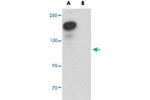 Western blot analysis of PLEKHM2 in rat brain tissue lysate with PLEKHM2 polyclonal antibody  at 0.