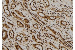 Immunohistochemistry (IHC) image for anti-Prostaglandin E Synthase 3 (Cytosolic) (PTGES3) (C-Term) antibody (ABIN6264507)