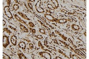 ABIN6277520 at 1/100 staining Human kidney tissue by IHC-P.