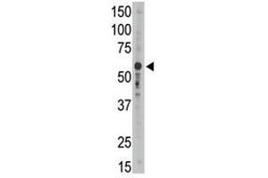 Image no. 2 for anti-Sialic Acid Binding Ig-Like Lectin 9 (SIGLEC9) (C-Term) antibody (ABIN357151) (SIGLEC9 抗体  (C-Term))