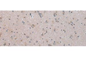 Immunohistochemistry of paraffin-embedded Human brain tissue using COX17 Polyclonal Antibody at dilution of 1:45(x200) (COX17 抗体)