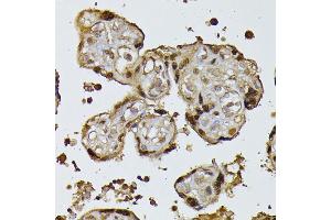 Immunohistochemistry of paraffin-embedded human placenta using RPS27A antibody (ABIN7270022) at dilution of 1:100 (40x lens). (RPS27A 抗体  (AA 1-156))