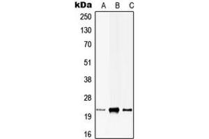 Western blot analysis of CIB1 expression in HEK293T (A), H9C2 (B), rat brain (C) whole cell lysates. (CIB1 抗体  (Center))