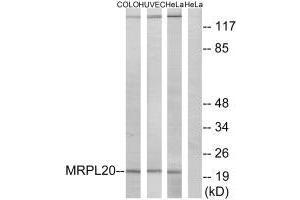 Western blot analysis of extracts from COLO cells, HUVEC cells and HeLa cells, using MRPL20 antibody. (MRPL2 抗体  (C-Term))