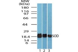 Image no. 1 for anti-Superoxide Dismutase antibody (ABIN1496240) (Superoxide Dismutase 抗体)