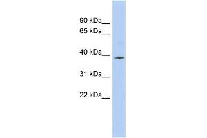 WB Suggested Anti-APOL6 Antibody Titration:  0. (APOL6 抗体  (Middle Region))