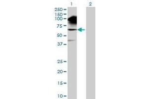 Lane 1: SNCAIP transfected lysate ( 66. (SNCAIP 293T Cell Transient Overexpression Lysate(Denatured))