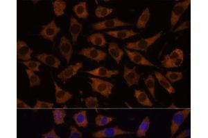 Immunofluorescence (IF) image for anti-Eukaryotic Translation Initiation Factor 5B (EIF5B) antibody (ABIN7258398)